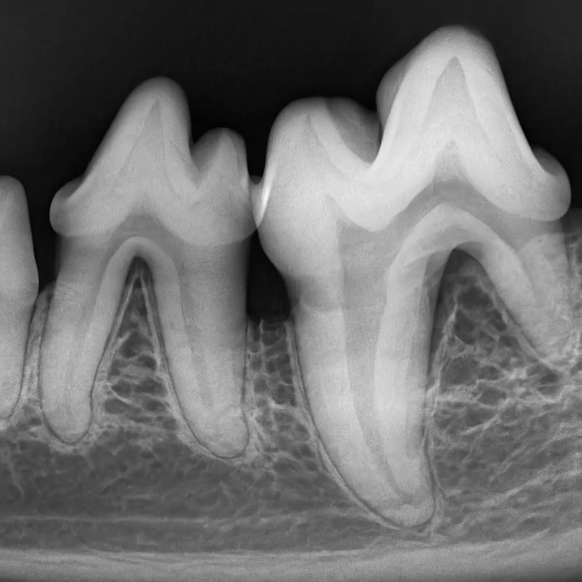 Tratamento de saúde dental (limpeza de tártaro) em pet - Arraial d'Ajuda
